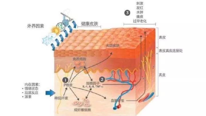 鄭州市“屏障修復(fù)”修復(fù)的是什么？不同膚質(zhì)該如何搭配？